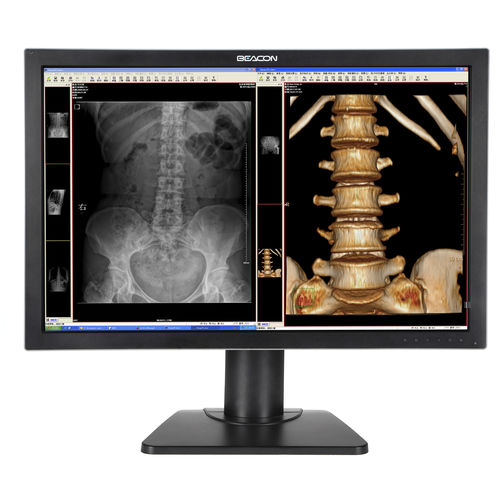 Monitor médico - C44W+ - Shenzhen Beacon Display Technology - de diagnóstico / de alta definición / 30"
