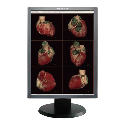 Monitor médico - C22S+ - Shenzhen Beacon Display Technology - para imágenes médicas / 21.3" / LED
