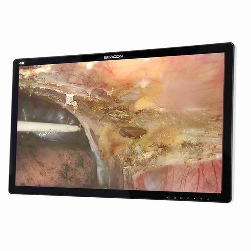 Monitor médico - S2785P - Shenzhen Beacon Display Technology - quirúrgico / 4K / 27"