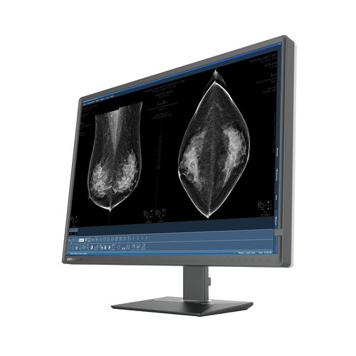 monitor mamográfico - Shenzhen Beacon Display Technology