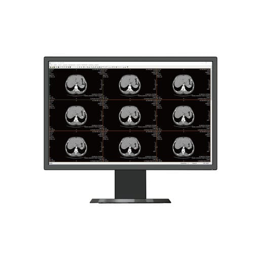 Monitor médico - HL2416SH - Shenzhen Beacon Display Technology - de radiología / de alta definición / 24"