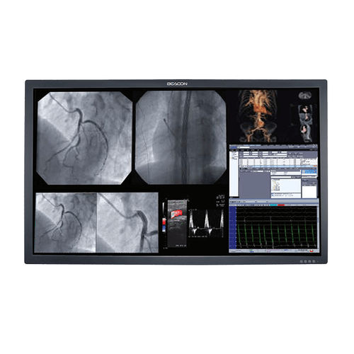 Monitor médico - S556P - Shenzhen Beacon Display Technology - 3.840x 2.160 / 55" / de alta luminosidad