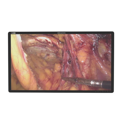 Monitor médico - S3285P-3D - Shenzhen Beacon Display Technology - para sala de operaciones / para endoscopia / quirúrgico