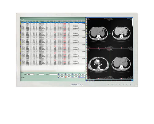 Monitor médico - HL2416SHT - Shenzhen Beacon Display Technology - de alta definición / 24" / LED