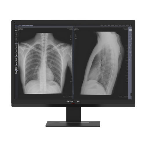 Monitor médico - C616W - Shenzhen Beacon Display Technology - de alta definición / 30" / de alta luminosidad