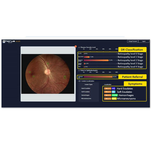 Software de oftalmoscopia - Medimaging Integrated Solution - de análisis de imágenes / detección de la retinopatía diabética / con inteligencia artificial