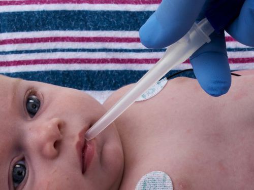 Cánula de aspiración de moco nasal - Little Sucker® - Neotech Products - pediátrica / neonatal / de látex