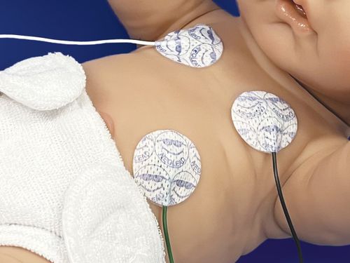 Electrodo ECG pediátrico - NeoLead® - Neotech Products