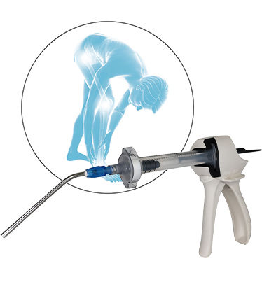 Sustituto óseo sintético - QUICKSET® - NORAKER - para cirugía ortopédica / maleable / pasta