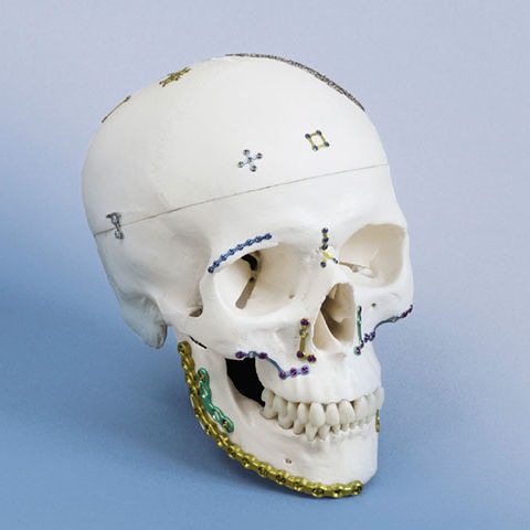 Placa de compresión para mandíbula - OPTIMUS - OSTEONIC - no bloqueada / metálica