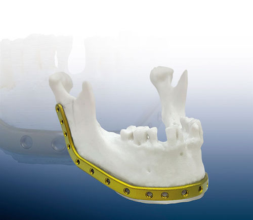 Placa de compresión para mandíbula - REAL FIT - OSTEONIC - bloqueada / de titanio