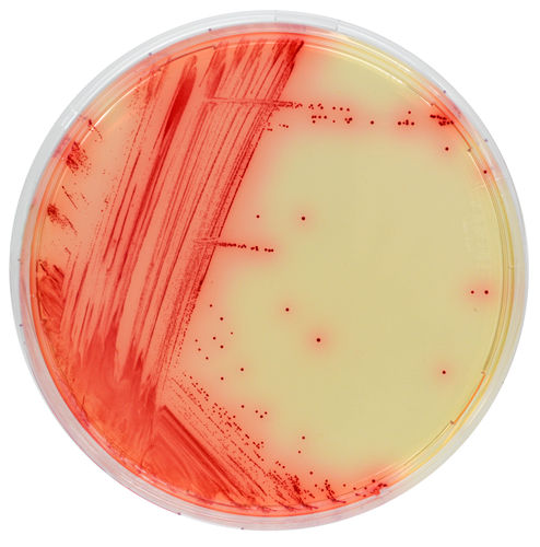 Medio reactivo - MB640 - CHROMagar - clínico / de laboratorio / Mycoplasma