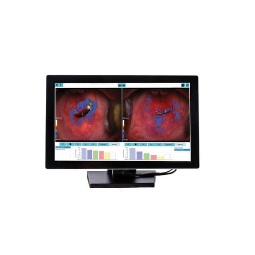Software de análisis - DYSISmap - DySIS Medical - de gestión / de educación / de evaluación