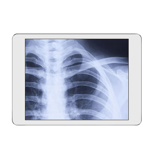 Sistema de adquisición para radiología - iRay DR - iRay Technology - portátil