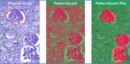 Software médico - QuantCenter - 3DHISTECH Ltd. - clínico / para la investigación / de análisis