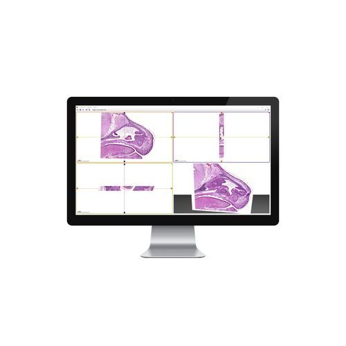 Software médico - 3DView - 3DHISTECH Ltd. - de control / 3D / 2D