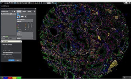 Plataforma de IA para hospitales - QuantServer - 3DHISTECH Ltd. - para imágenes médicas / de laboratorio de histopatología / para la investigación médica