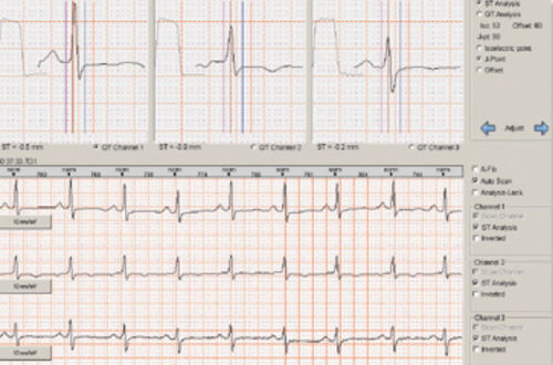 Software de análisis - Braemar C1000   - Braemar - para Holter cardíaco
