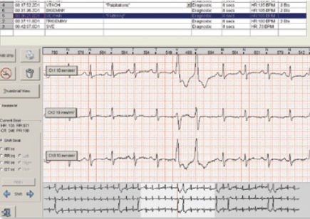 Software de análisis - Braemar C3000 - Braemar - de gestión de datos / de diseño / para Holter cardíaco