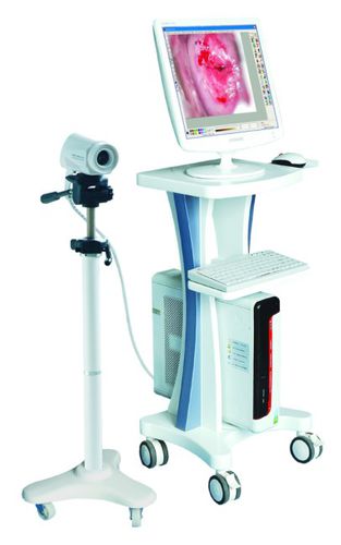 Colposcopio vídeo - LEO-2100I  - Xuzhou Leo Medical Equipments - en carro