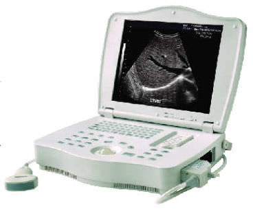 Ecógrafo portátil - LEO-3000E1  - Xuzhou Leo Medical Equipments - para ecografía polivalente / blanco y negro / consola integrada