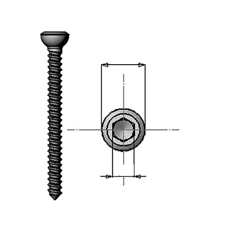Tornillo de compresión ósea genérico - 36.200 series - Medicalex - de acero inoxidable / no bloqueado / cortical