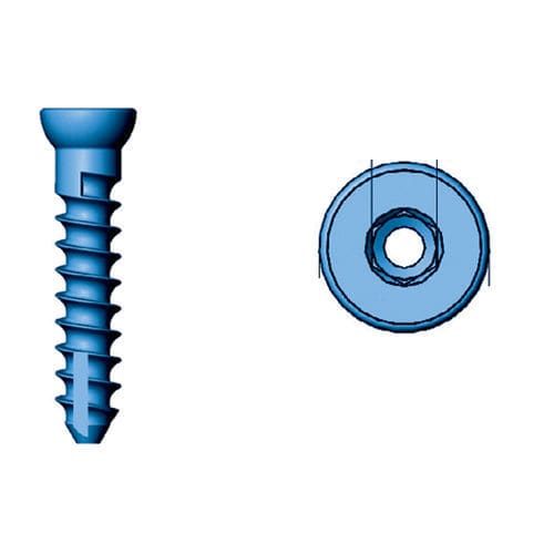 Tornillo de compresión ósea para epífisis - 36.241 series - Medicalex - canulado / de titanio / bloqueado