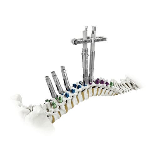 Sistema de posicionamiento de tornillos pediculares - CREO® Derotation - Globus Medical