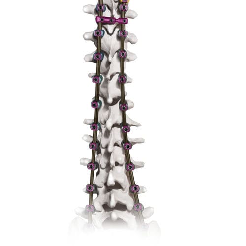 Sistema de osteosíntesis toraco-lumbo-sacro - CREO AMP® - Globus Medical - vía posterior / para adulto