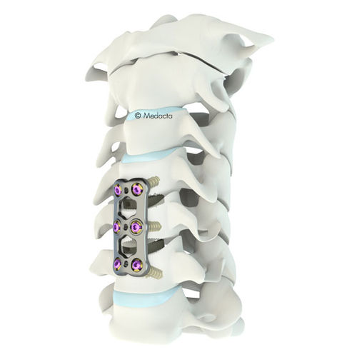 Placa de artrodesis cervical - Mecta®-C  - Medacta - bloqueada / metálica