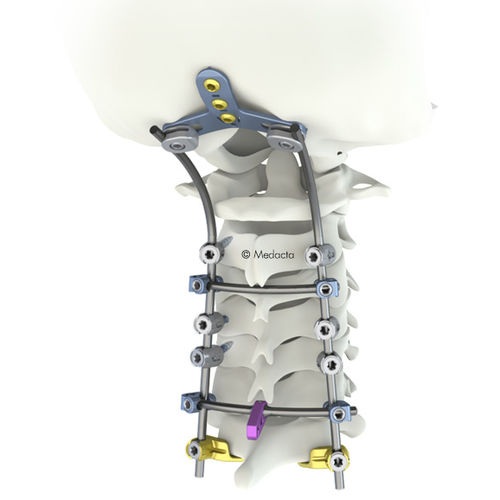 Sistema de osteosíntesis occipitocervicotorácico - M.U.S.T. Mini - Medacta - vía posterior / para adulto