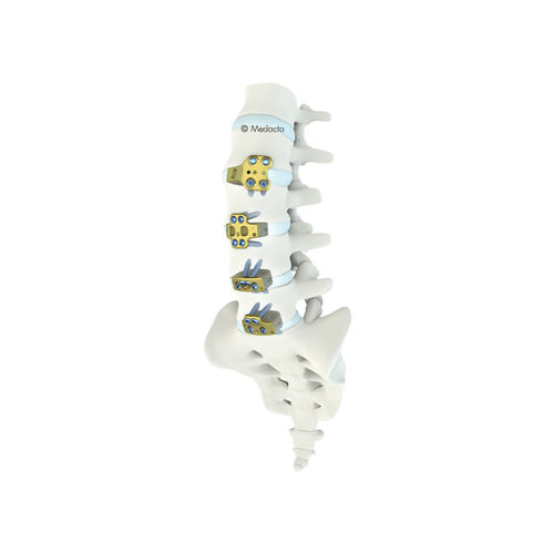 Caja intersomática toracolumbar - MectaLIF® - Medacta - vía anterior / de titanio