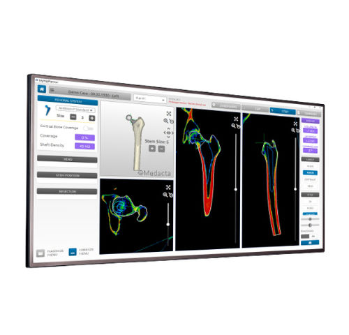 Software de análisis - MyHip® - Medacta - de planificación / TDM / de cadera