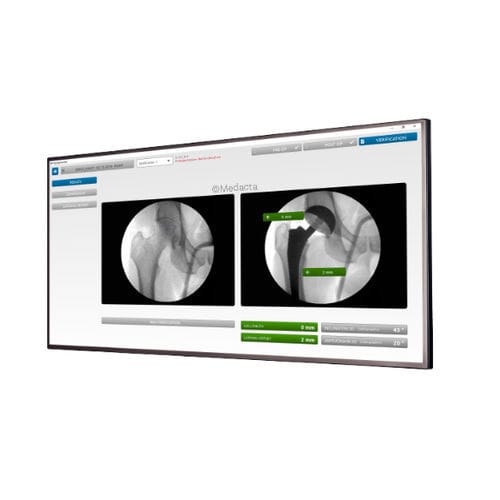 Software de verificación - MyHip® - Medacta - para cirugía de la cadera / de cadera / para tablet PC