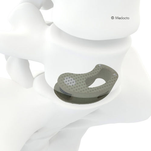 Caja intersomática toracolumbar - MectaLIF® - Medacta - vía oblicua / de titanio / de PEEK