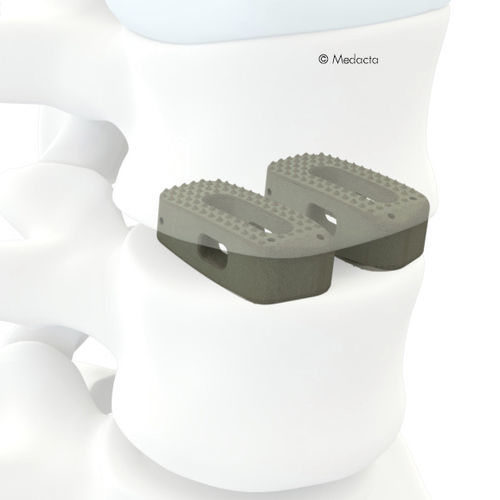 Caja intersomática toraco-lumbo-sacra - MectaLIF® - Medacta - vía posterior / de titanio / de PEEK