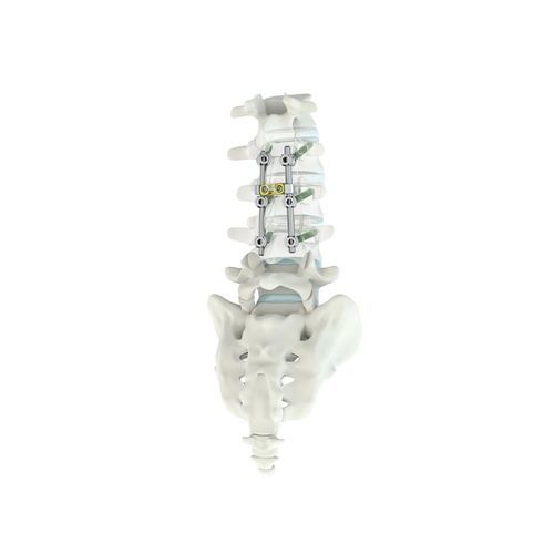 Sistema de osteosíntesis toracolumbar - M.U.S.T.® MC - Medacta - vía posterior / para adulto