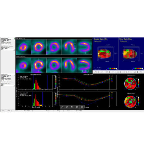 Software médico - InterView™ XP - Mediso - SPECT / cardíaco / para medicina nuclear