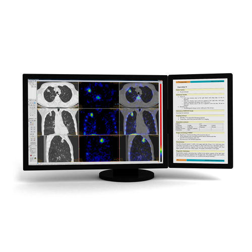 Software médico - InterView™ FUSION - Mediso - para imágenes médicas / de visualización / de evaluación
