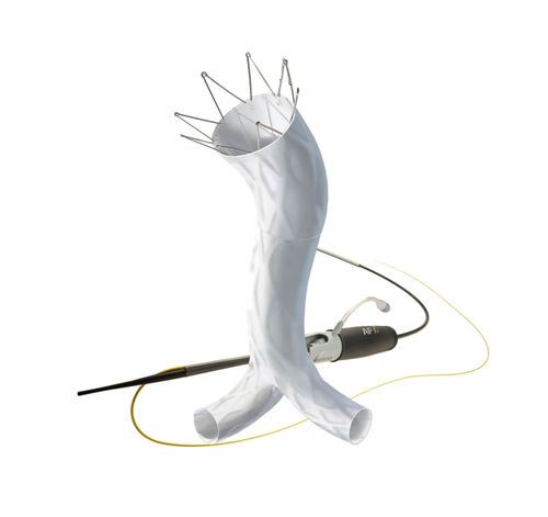 Stent-injerto aorta abdominal - AFX®  - Endologix - de ePTFE