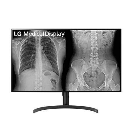 Monitor médico - 32HL512D - LG - para imágenes médicas / de diagnóstico / de radiología