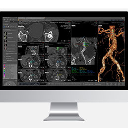 Módulo de software médico - Myrian® XP-Vessel - Intrasense - de análisis / de visualización / de planificación