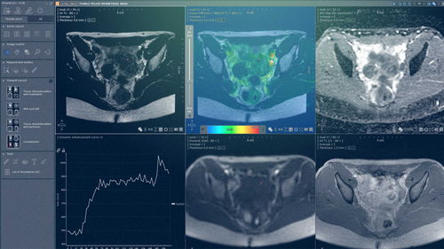 Módulo de software clínico - MYRIAN®XP-FEMALE - Intrasense - de análisis / de visualización / de pelvis