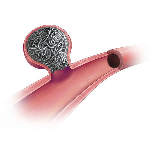 Espiral de embolización retractable - Ruby® - Penumbra