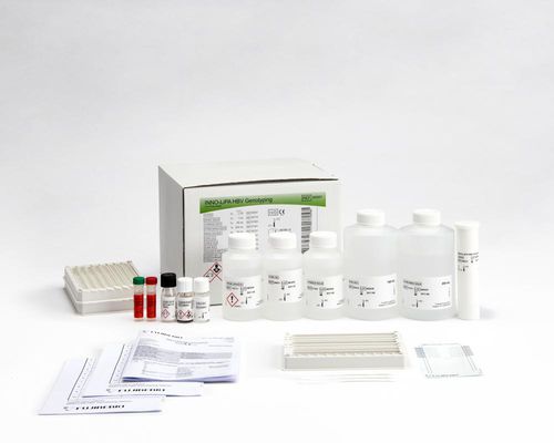 Kit de prueba de hepatitis B - INNO-LiPA® - Fujirebio - VHB / automático / con tira reactiva