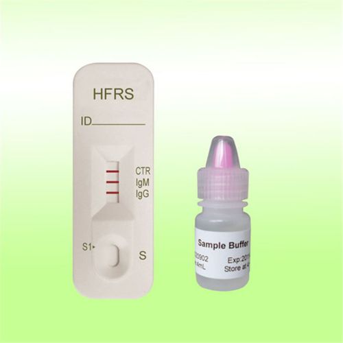 Prueba rápida para enfermermedades infecciosas - 1N03C2 - Boson Biotech Co., Ltd. - de IgG / de IgM / de suero