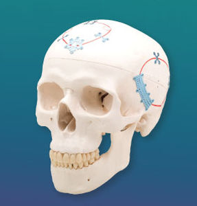Sistema de fijación craneal no reabsorbible - NeuroPro®  - Kinamed