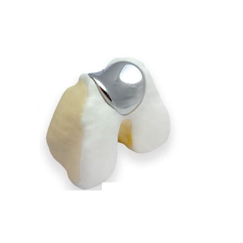 Prótesis patelofemoral - KineMatch® - Kinamed