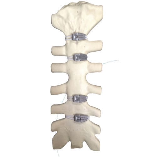 Cierre esternal tipo cerclaje - SuperCable® Iso-Elastic™ - Kinamed - polímero multifilamento