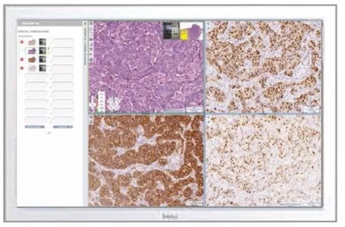 PACS para imágenes médicas - Aperio eSlide Manager - Leica Biosystems - para hospital / médico / clínico